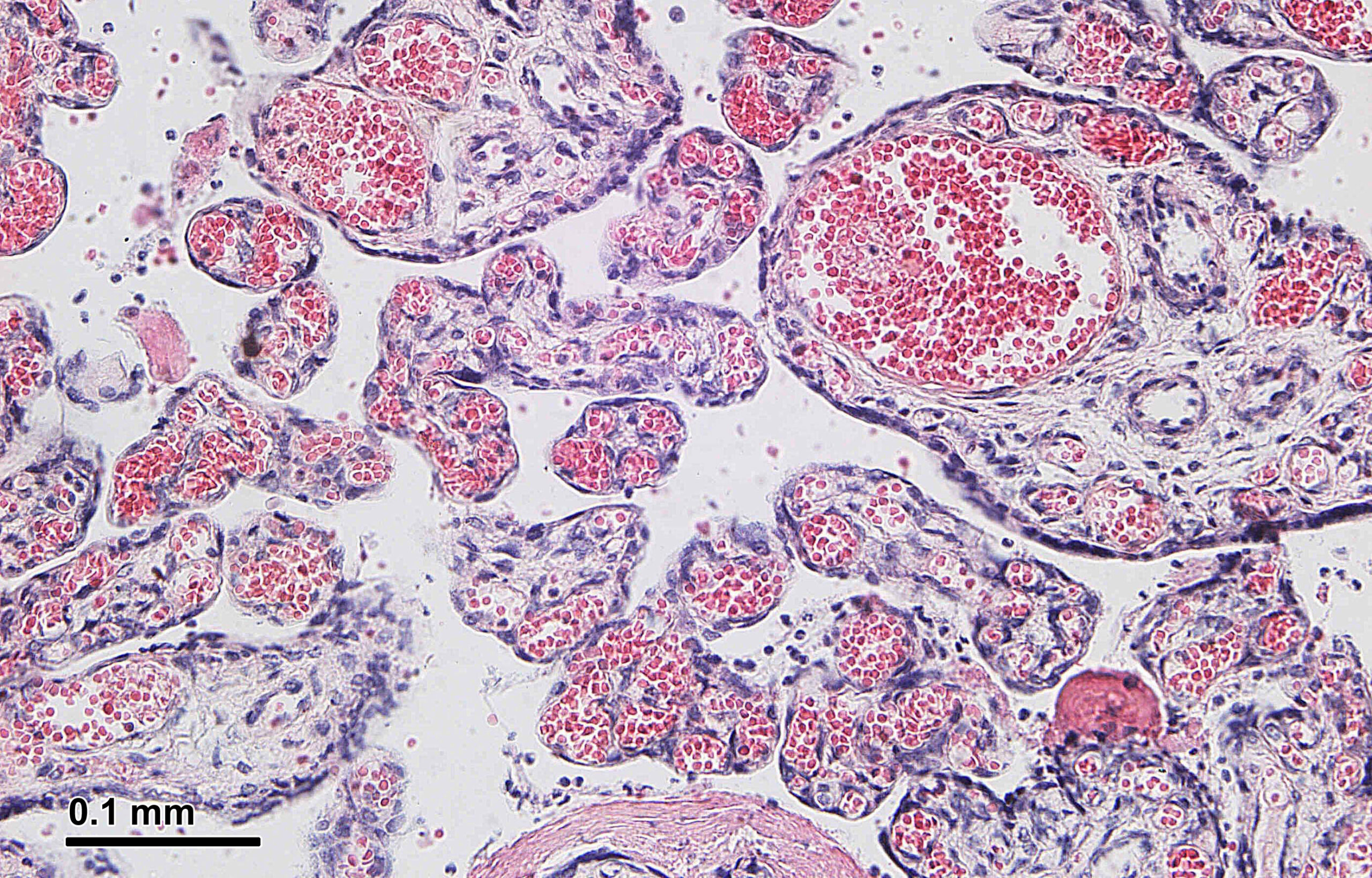 H&E-stained microscopic cross-section of human placental tissue in pink and violet tones.