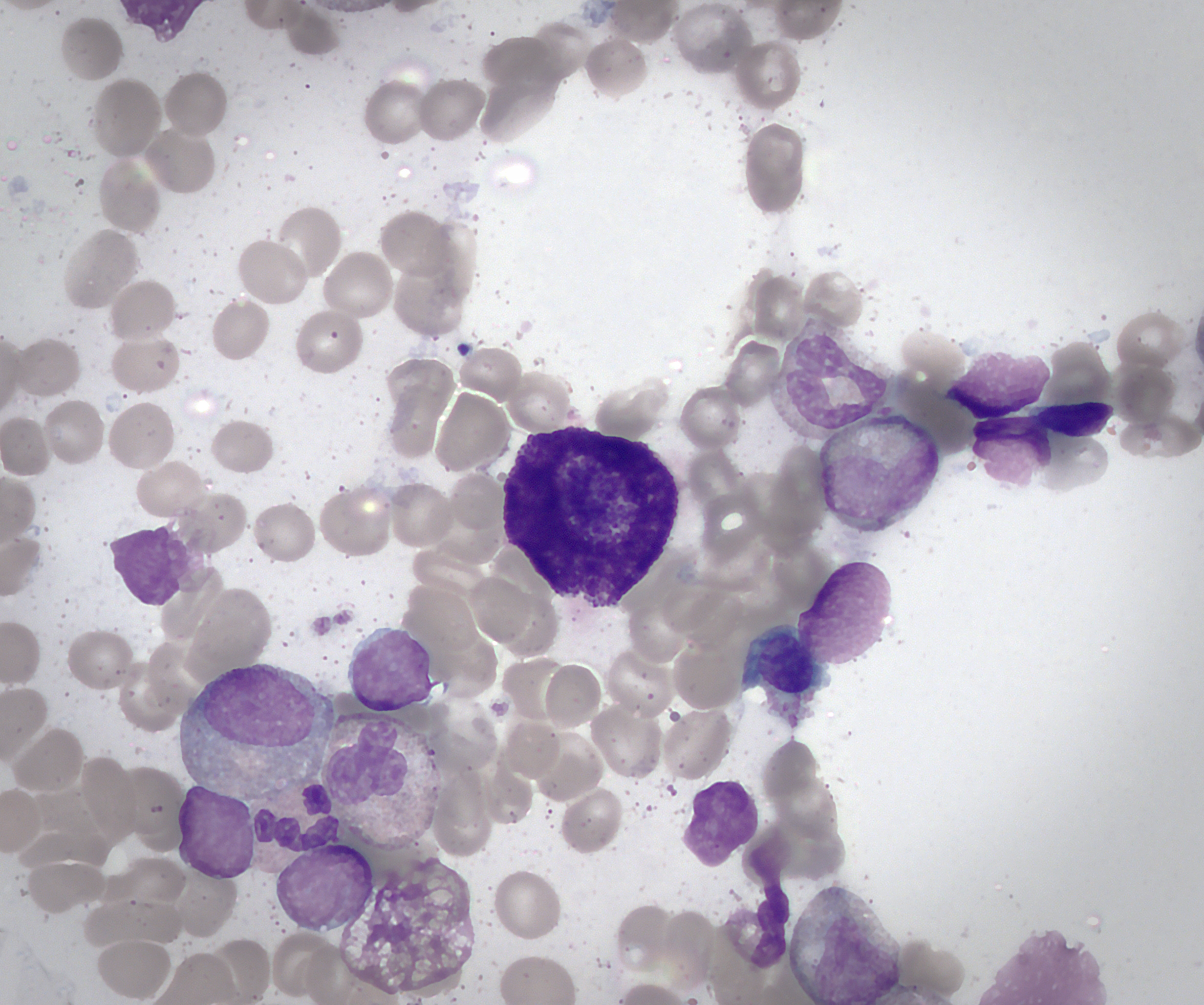 Bone-marrow micrograph with a large dark-purple mast cell among paler blood-forming cells.
