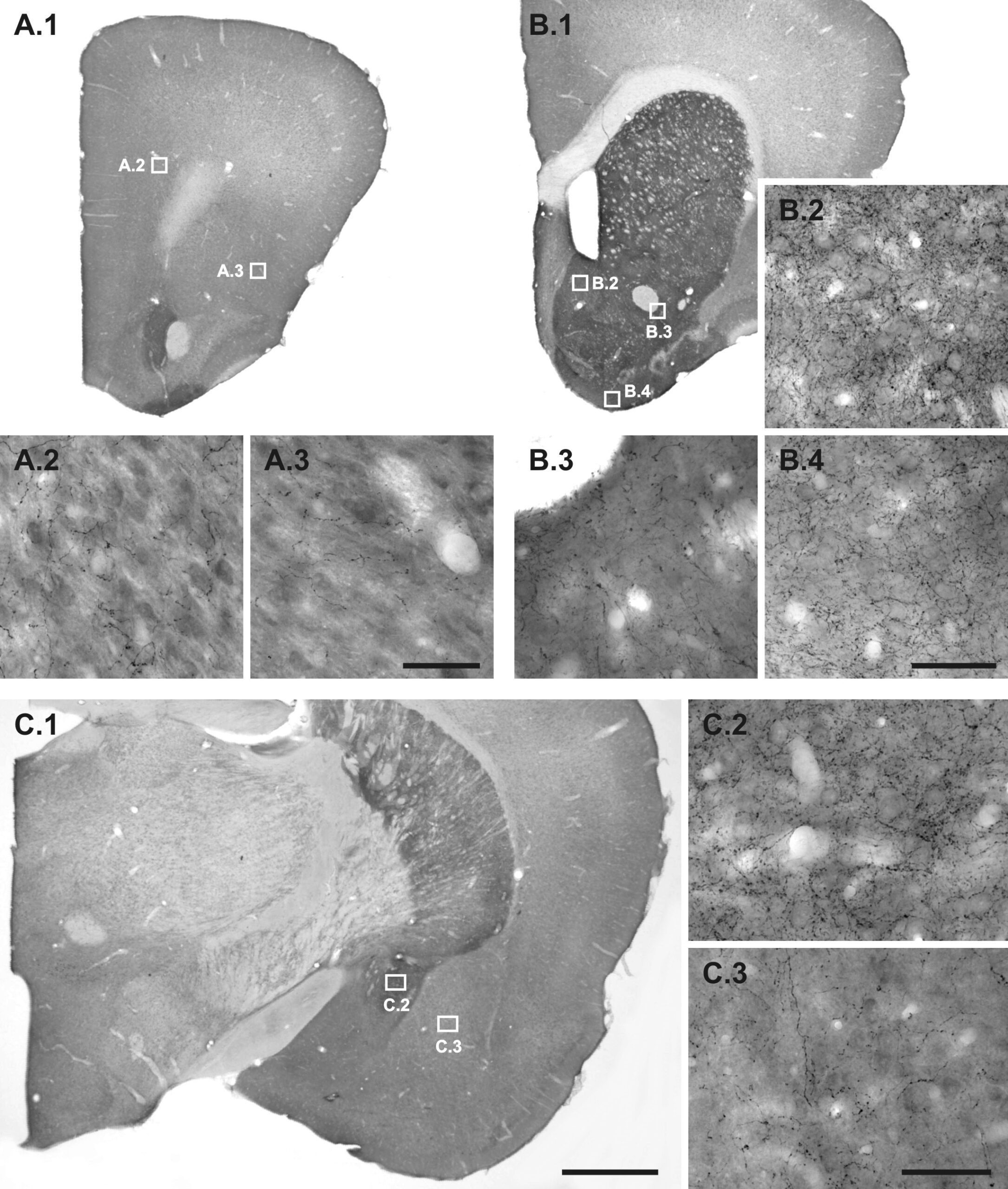 Comparative grayscale micrographs of dopamine-immunoreactive fibres in several regions of a gerbil brain.
