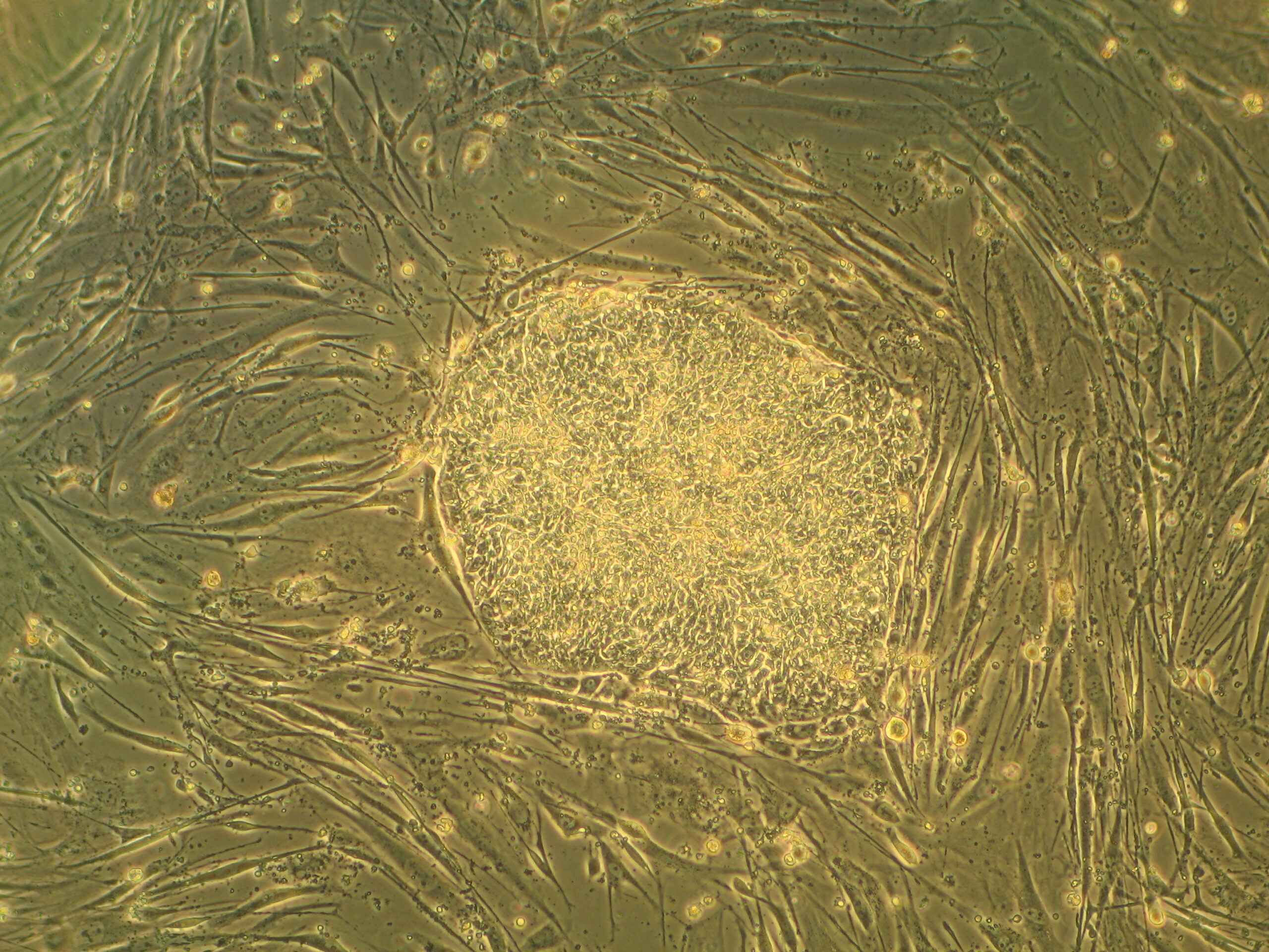 Microscope image of a dense human embryonic stem-cell colony surrounded by paler support cells.