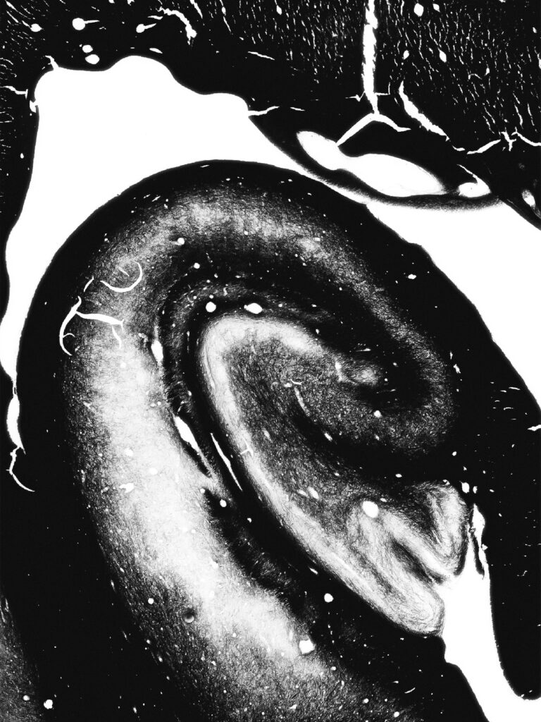 High-contrast silver-stained microscope mosaic of a human hippocampus and its myelinated pathways.