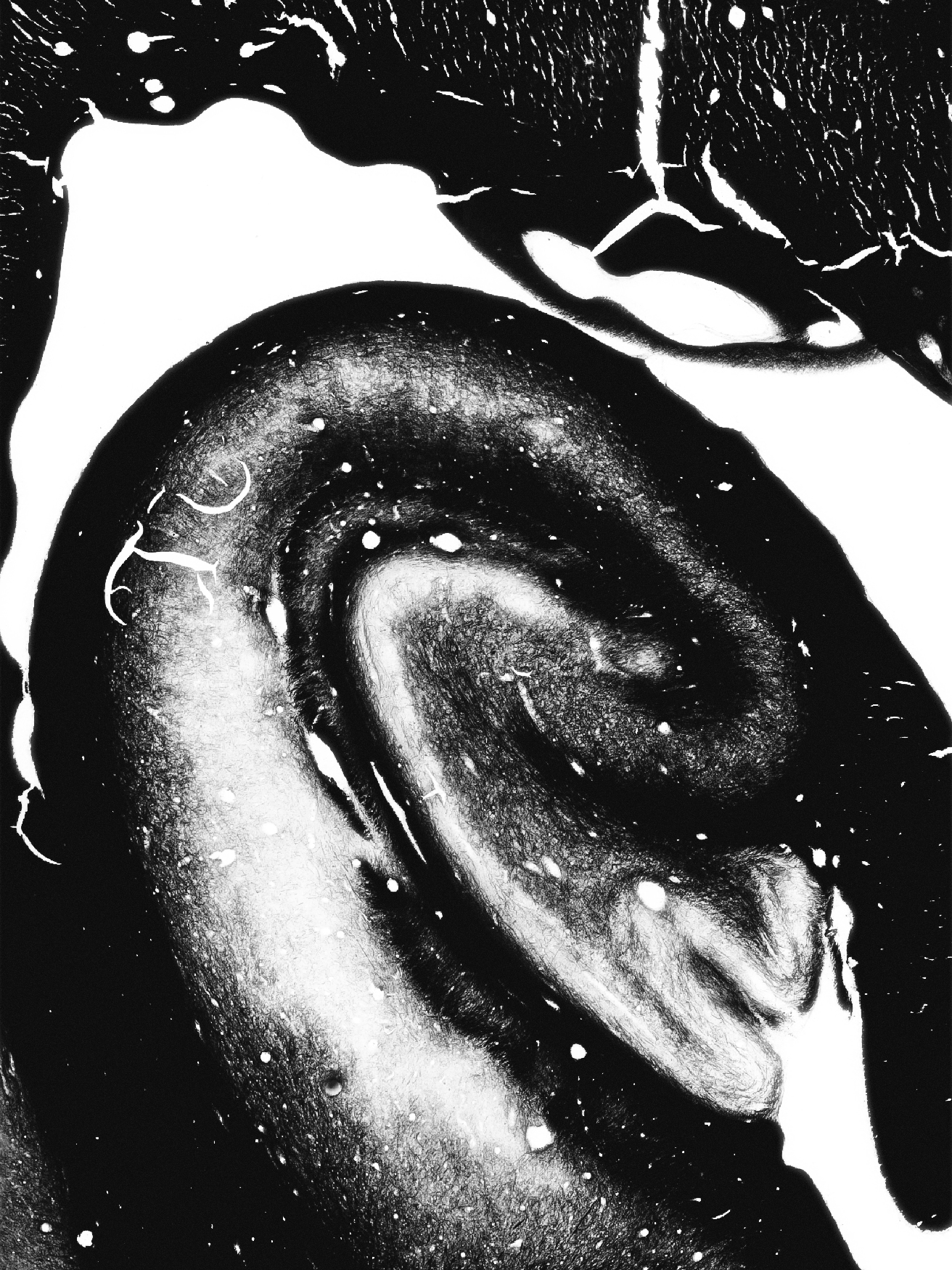 High-contrast silver-stained microscope mosaic of a human hippocampus and its myelinated pathways.