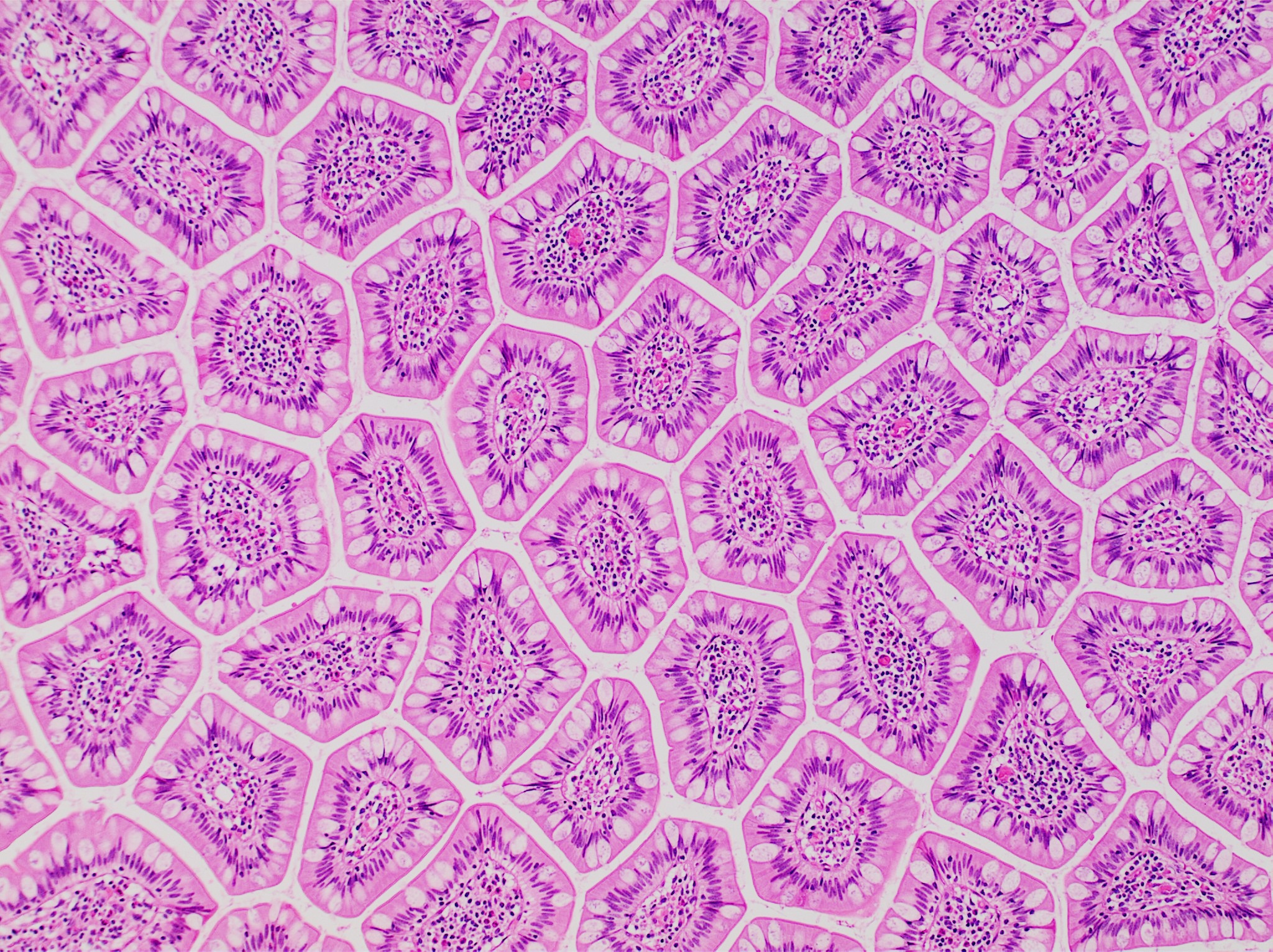 H&E-stained cross-section of human terminal-ileum villi in pink and violet tones.